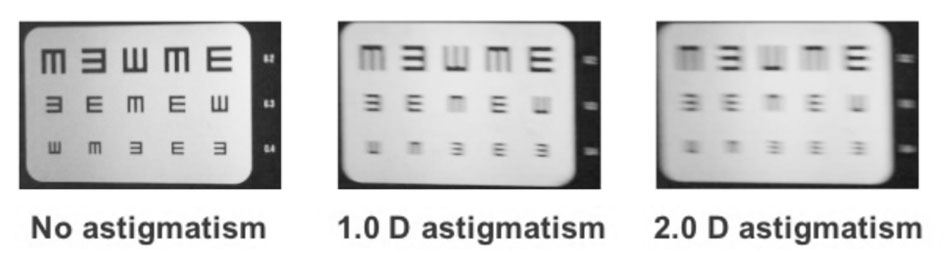 Toric intraocular lenses are designed to reduce the amount of astigmatism in the visual system
